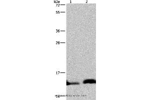 Western blot analysis of Human hepatocellular carcinoma and fetal brain tissue, using NDUFA5 Polyclonal Antibody at dilution of 1:400 (NDUFA5 抗体)