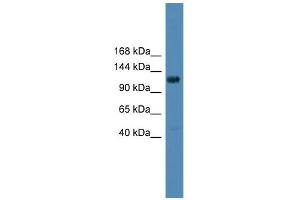 WB Suggested Anti-DGKQ Antibody Titration: 0. (DGKQ 抗体  (Middle Region))