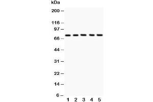 Western blot testing of 12 Lipoxygenase antibody and Lane 1:  A549;  2: MCF-7;  3: COLO320;  4: Jurkat;  5: HeLa;  Predicted size: 75KD;  Observed size: 75KD (12-Lipoxygenase 抗体  (C-Term))