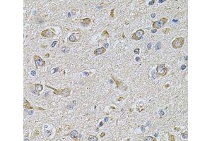 Immunohistochemistry of paraffin-embedded Rat brain using FASTKD1 Polyclonal Antibody at dilution of 1:100 (40x lens). (FASTKD1 抗体)