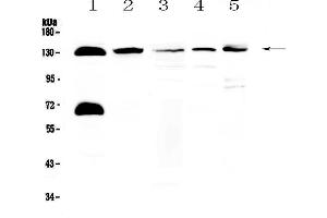 Western blot analysis of NEDD4-2 using anti-NEDD4-2 antibody . (NEDD4-2 抗体  (AA 703-975))