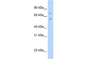 WB Suggested Anti-FOXK1 Antibody Titration:  2. (Foxk1 抗体  (C-Term))