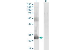 Western Blot analysis of CCDC115 expression in transfected 293T cell line by CCDC115 monoclonal antibody (M05), clone 4E9. (CCDC115 抗体  (AA 1-132))