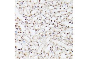 Immunohistochemistry of paraffin-embedded Mouse kidney using EP300 antibody (ABIN6127823, ABIN6140193, ABIN6140194 and ABIN6216844) at dilution of 1:100 (40x lens). (p300 抗体  (AA 1-270))