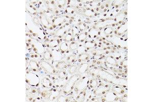 Immunohistochemistry of paraffin-embedded Mouse kidney using EP300 antibody (ABIN6127823, ABIN6140193, ABIN6140194 and ABIN6216844) at dilution of 1:100 (40x lens).