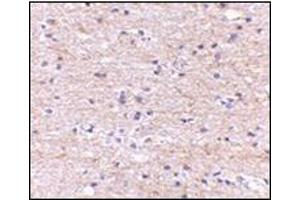 Immunohistochemistry of SATB2 in human brain with this product at 5 μg/ml. (SATB2 抗体  (N-Term))