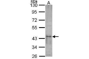WB Image Sample (30 ug of whole cell lysate) A: NT2D1 10% SDS PAGE SKAP55 antibody antibody diluted at 1:1000 (SKAP1 抗体)