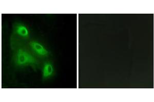 Immunofluorescence analysis of HeLa cells, using ES8L3 antibody. (EPS8-Like 3 抗体  (Internal Region))