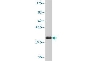 Western Blot detection against Immunogen (35. (SLC27A5 抗体  (AA 90-175))