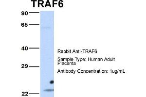 Host: Rabbit Target Name: TRAF6 Sample Type: Human Adult Placenta Antibody Dilution: 1. (TRAF6 抗体  (Middle Region))