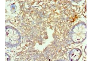 Immunohistochemistry of paraffin-embedded human colon tissue using ABIN7160219 at dilution of 1:100 (MORF4L1 抗体  (AA 1-100))