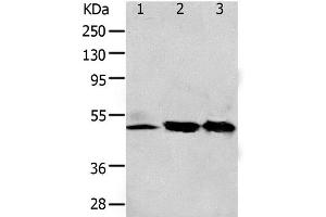 Western Blot analysis of 293T and K562 cell, Human fetal kidney tissue using F2R Polyclonal Antibody at dilution of 1:650 (PAR1 抗体)