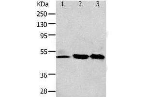 Western Blot analysis of 293T and K562 cell, Human fetal kidney tissue using F2R Polyclonal Antibody at dilution of 1:650 (PAR1 抗体)