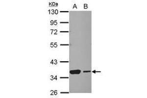 Image no. 3 for anti-Heat Shock Transcription Factor 2 Binding Protein (HSF2BP) (AA 1-259) antibody (ABIN1501895) (HSF2BP 抗体  (AA 1-259))