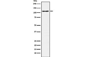 Western blot analysis of CD162 expression in Jurkat cell lysate.
