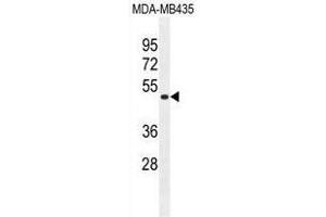 TAPT1 Antibody (C-term) western blot analysis in MDA-MB435 cell line lysates (35ug/lane). (TAPT1 抗体  (C-Term))