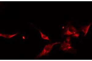 ABIN6275053 staining HeLa cells by IF/ICC. (DOCK1 抗体  (C-Term))