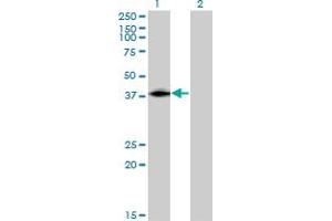 Western Blot analysis of ISL2 expression in transfected 293T cell line by ISL2 monoclonal antibody (M03), clone 1D9. (ISL2 抗体  (AA 261-358))