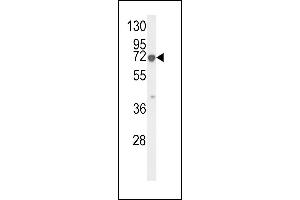 Western blot analysis of KRT9 Antibody (Center ) (ABIN652316 and ABIN2841447) in HL-60 cell line lysates (35 μg/lane). (KRT9 抗体  (AA 302-331))