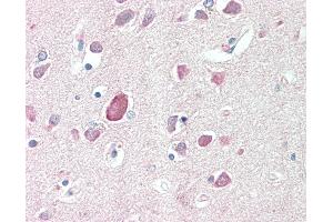 Anti-PTGDS / PGDS antibody IHC staining of human brain, cortex. (PTGDS 抗体  (AA 27-38))