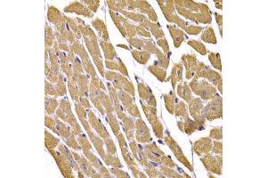 Immunohistochemistry of paraffin-embedded mouse heart using SLC2A4 antibody (ABIN5995371) at dilution of 1/100 (40x lens). (GLUT4 抗体)