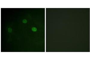 Immunofluorescence analysis of COS7 cells, using CDK1 (Phospho-Thr14) antibody. (CDK1 抗体  (pThr14))