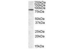 Image no. 1 for anti-Tripartite Motif Containing 3 (TRIM3) (N-Term) antibody (ABIN374306) (TRIM3 抗体  (N-Term))