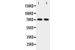 Anti-Prolactin Receptor antibody, Western blotting Lane 1: HELA Cell Lysate Lane 2: MCF-7 Cell Lysate (Prolactin Receptor 抗体  (C-Term))