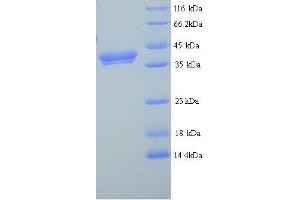SDS-PAGE (SDS) image for Erythroferrone (ERFE) (AA 25-340) protein (His tag) (ABIN5714398)