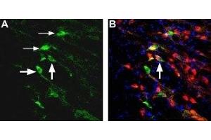 Immunohistochemistry (IHC) image for anti-Glutamate Receptor, Ionotropic, N-Methyl D-Aspartate 2D (GRIN2D) (AA 345-359), (Extracellular) antibody (ABIN7043232)
