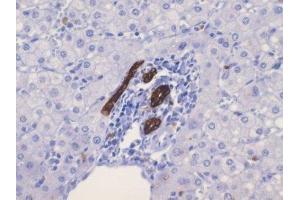 Immunohistochemistry (IHC) image for anti-Keratin 19 (KRT19) (C-Term) antibody (ABIN870577) (Cytokeratin 19 抗体  (C-Term))