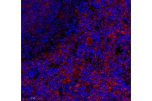 Immunofluorescence of paraffin embedded rat spleen using CD163b (ABIN7073371) at dilution of 1: 700 (350x lens) (CD163L1 抗体)