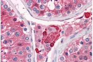 Human Testis: Formalin-Fixed, Paraffin-Embedded (FFPE) (GSTA3 抗体  (AA 1-223))