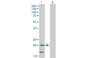 Western Blot analysis of NDUFS4 expression in transfected 293T cell line by NDUFS4 monoclonal antibody (M01), clone 1A1.