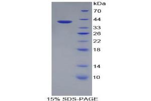 SDS-PAGE analysis of Rat Apolipoprotein A2 Protein. (APOA2 蛋白)