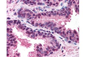 Anti-DR5 antibody IHC of human prostate.