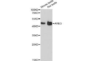 Western blot analysis of extracts of various cell lines, using AREG antibody (ABIN6290061) at 1:3000 dilution. (Amphiregulin 抗体)