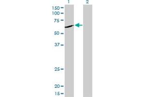Western Blot analysis of NEK11 expression in transfected 293T cell line by NEK11 monoclonal antibody (M01), clone 4E1-1F4. (NEK11 抗体  (AA 1-482))
