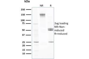SDS-PAGE Analysis Purified Transthyretin Mouse Monoclonal Antibody (CPTC-TTR-1). (TTR 抗体)
