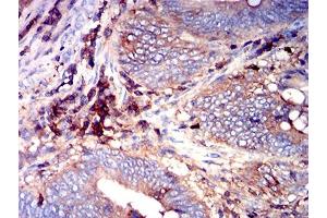 Immunohistochemistry (IHC) image for anti-CD97 (CD97) (AA 419-552) antibody (ABIN7193255)