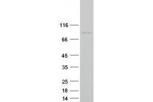 Validation with Western Blot