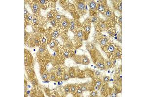 Immunohistochemistry of paraffin-embedded human liver injury using MYO1C antibody at dilution of 1:100 (x40 lens). (Myosin IC 抗体)