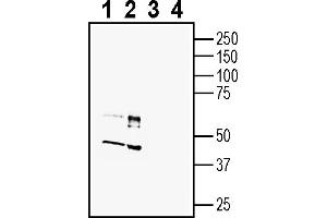 Western blot analysis of mouse brain membranes (lanes 1 and 3) and rat brain membranes (lanes 2 and 4):1-2. (C3AR1 抗体  (Extracellular))