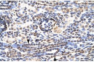 Rabbit Anti-KL9 Antibody  Paraffin Embedded Tissue: Human Kidney Cellular Data: Epithelial cells of renal tubule Antibody Concentration: 4. (KLF9 抗体  (N-Term))