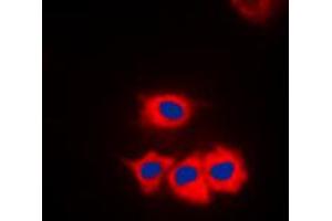 Immunofluorescent analysis of CK1 gamma 1 staining in Jurkat cells. (CSNK1G1 抗体  (N-Term))