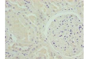 Immunohistochemistry of paraffin-embedded human kidney tissue using ABIN7161010 at dilution of 1:100 (NADPH Oxidase 4 抗体  (AA 210-424))