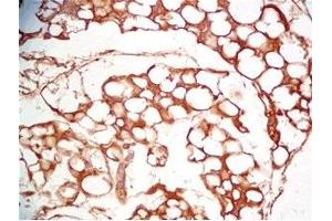 Mouse visceral fat tissue was stained by Rabbit Anti-Cathepsin S (298-331) (Human) Serum (Cathepsin S 抗体  (AA 298-331))