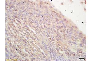 Immunohistochemistry (IHC) image for anti-Nuclear Receptor Subfamily 2, Group C, Member 2 (NR2C2) (AA 501-596) antibody (ABIN707846)