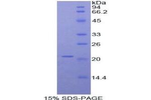 SDS-PAGE (SDS) image for ADAM Metallopeptidase with thrombospondin Type 1 Motif, 12 (ADAMTS12) protein (ABIN3008050)