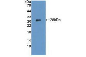 Detection of Recombinant LYPLA1, Human using Polyclonal Antibody to Lysophospholipase I (LYPLA1) (LYPLA1 抗体  (AA 1-230))
